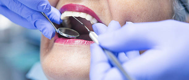 Best Emergency Broken Tooth Repair in Ntgomery City, MO